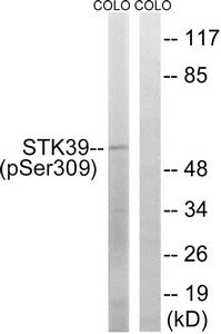 Phospho-STK39 (Ser311) Antibody