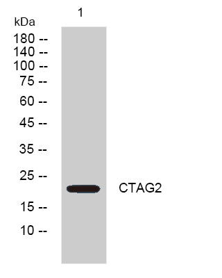 CTAG2 Antibody