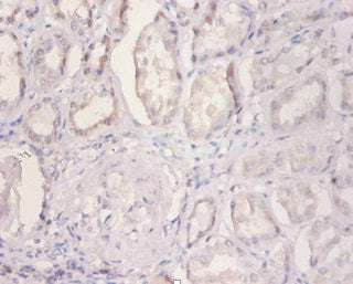 NDUFA2 Antibody