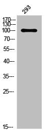 Phospho-PGR (S294) Antibody