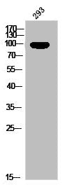 Phospho-PGR (S400) Antibody
