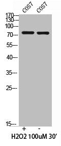 Phospho-PIK3R1/PIK3R3 (Y467/199) Antibody