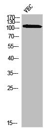 Phospho-PLA2G4A (S505) Antibody