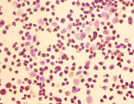 HOMER1 Antibody