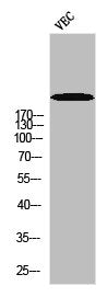 Phospho-POLR2A (S1619) Antibody