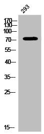 Phospho-PRKCA (Y657) Antibody