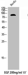 Phospho-AXL (Y691) Antibody