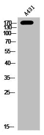 Phospho-PRKD1 (S910) Antibody
