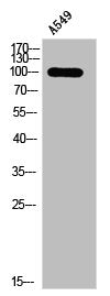 Phospho-PRKD1/PRKD2/PRKD3 (S738/S742) Antibody