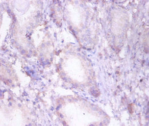 HADHB Antibody