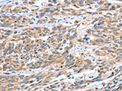 CGB Antibody