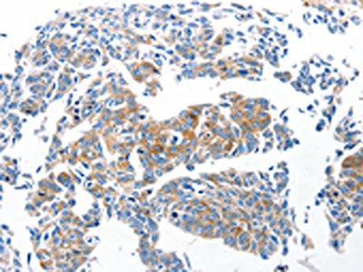Ccl6 Antibody
