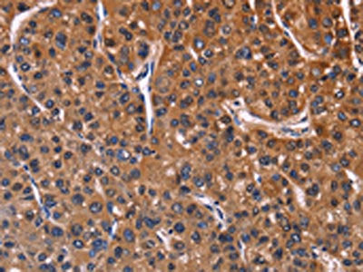 NFATC3 Antibody
