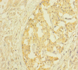 CLTB Antibody