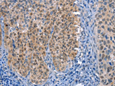 UCK1 Antibody