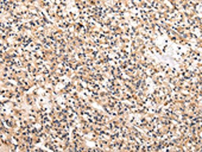 USP5 Antibody