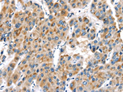 UCP2 Antibody