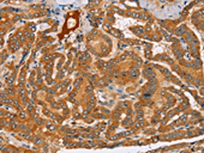 PEA15 Antibody