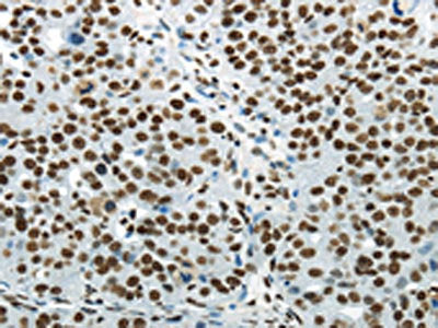 HNRNPM Antibody