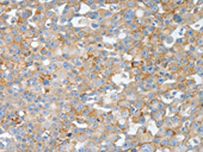 BPIFB2 Antibody