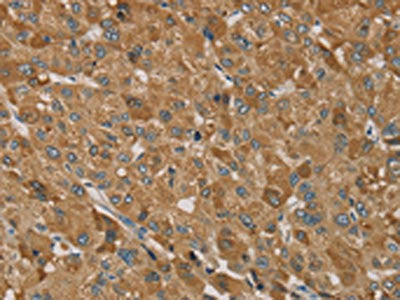 TRIM40 Antibody