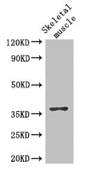 DNAJB6 Antibody