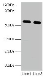 PHGDH Antibody