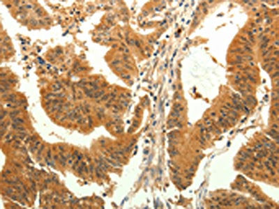 TRPM7 Antibody