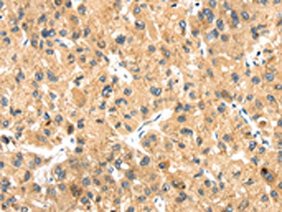 LLGL2 Antibody