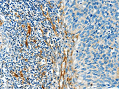 DIO2 Antibody