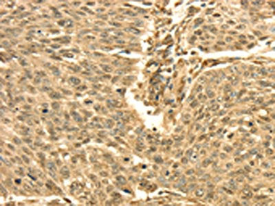 SEPT2 Antibody