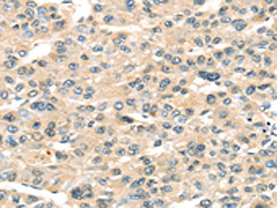 HAUS7 Antibody