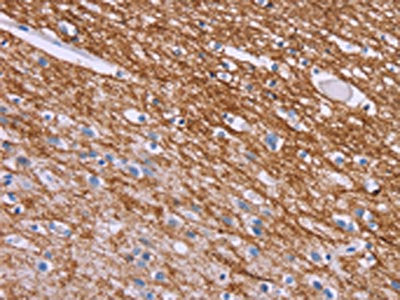 CRH Antibody