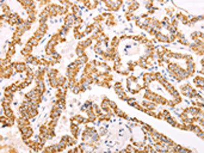 ATPIF1 Antibody