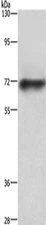 ABCB8 Antibody