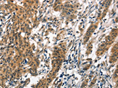 SMAD3 Antibody
