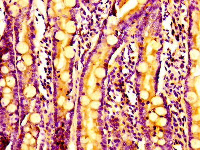 ARPC2 Antibody