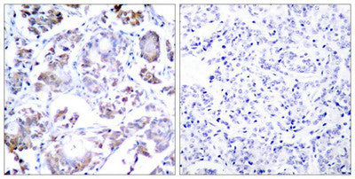RELA (Ab-254) Antibody