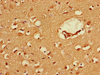 FEZ1 Antibody