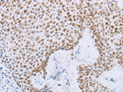 MCM2 Antibody