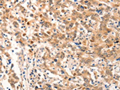 NOX4 Antibody