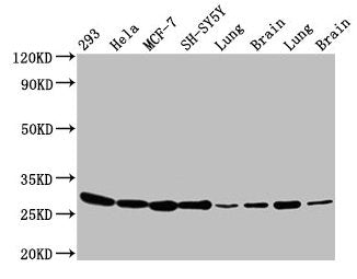 BCAP31 Antibody