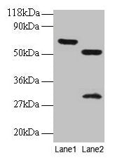 ZNF384 Antibody