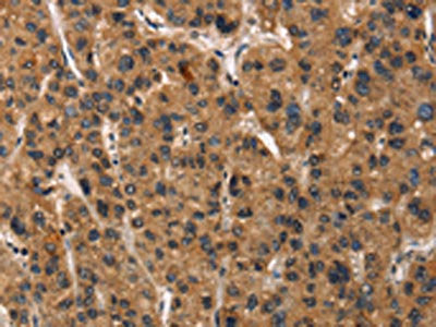 DEFA5 Antibody