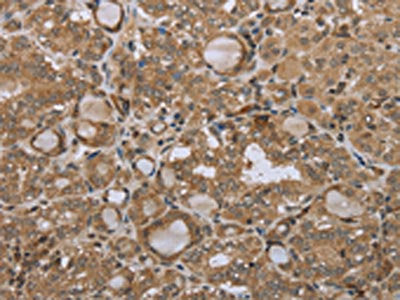 STMN2/STMN3/STMN4 Antibody