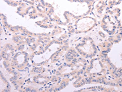 ACOT2 Antibody
