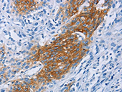 CCR9 Antibody
