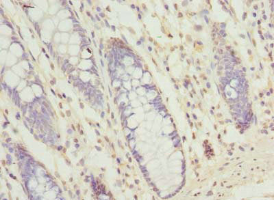 SEC61G Antibody