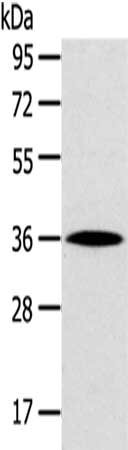 HOXD13 Antibody