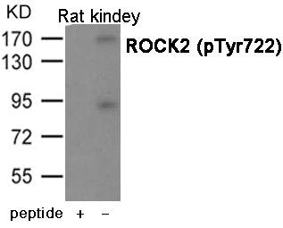 Phospho-ROCK2 (Tyr722) Antibody